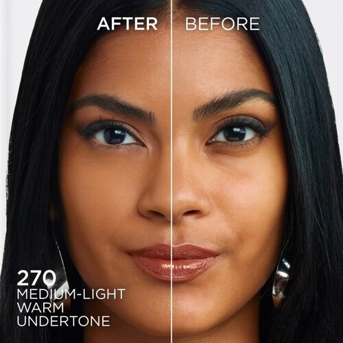 L’ORÉAL PARIS 2