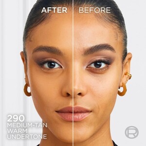 L’Oréal Paris 2