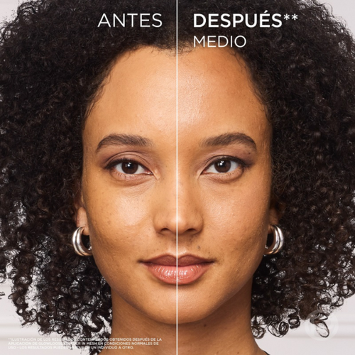 L’Oréal Paris 4