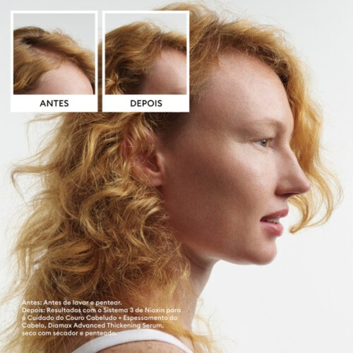 Nioxin Sistema 1 3