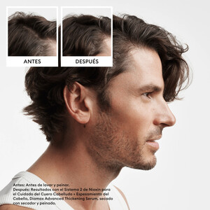 Nioxin Sitema PACK 2 4