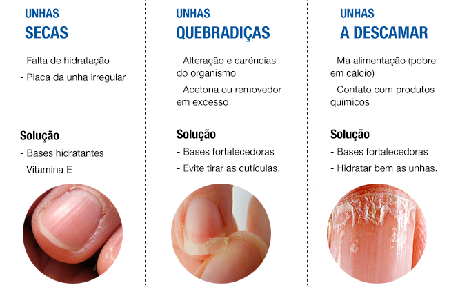 blog_unhasProblemas